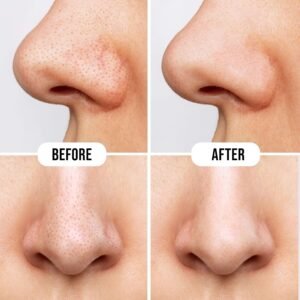 Hilary Rhoda Charcoal Nose Strips Pack of 10 Strips for Blackhead & Whitehead Remover | Deep Cleansing Pore Strips for Nose | Oil Control Formula (Charcoal - Shade 01)